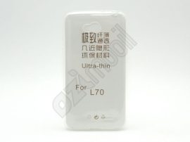 Ultra Slim 0,3 mm - LG L70 - szilikon tok - átlátszó